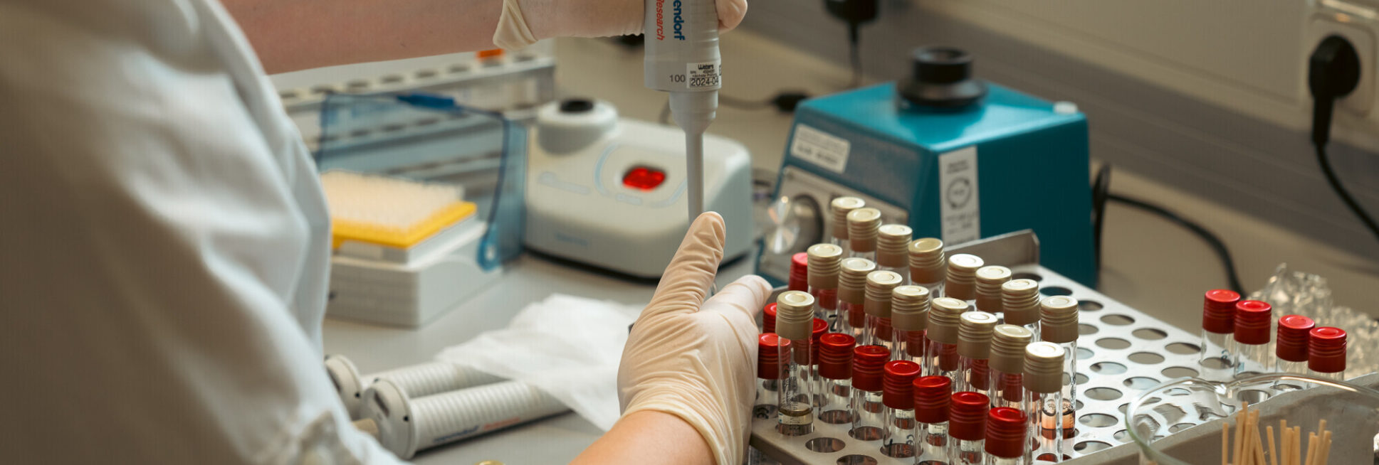 Projekt „MastiSelect“: Proben werden analysiert.